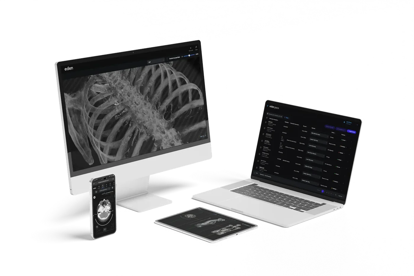 Eden PACS en monitor, laptop, tableta y teléfono